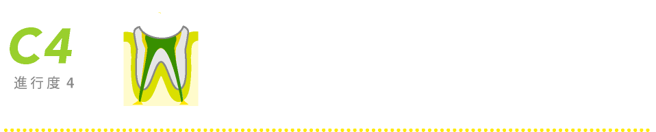 進行度4