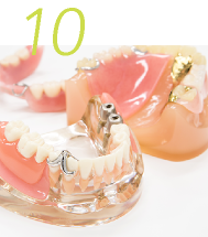 義歯やマウスピースなどできるだけ早く製作できるよう努めています。